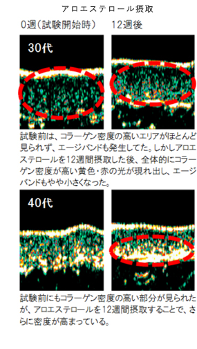 図)アロエステロール摂取