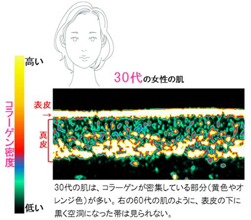 30代の女性の肌