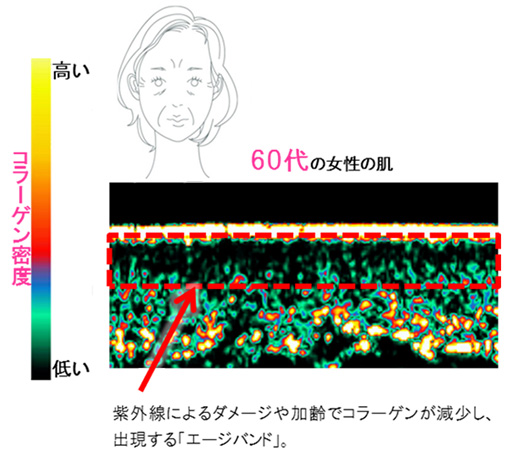 60代の女性の肌
