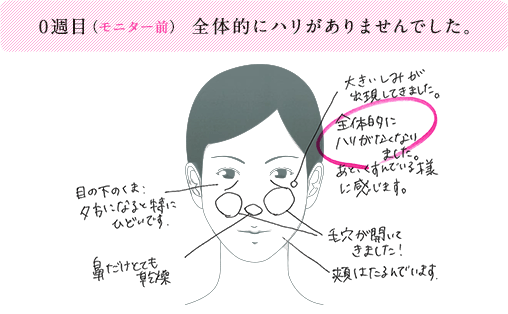0週目（モニター前）全体的にハリがなくなりました。