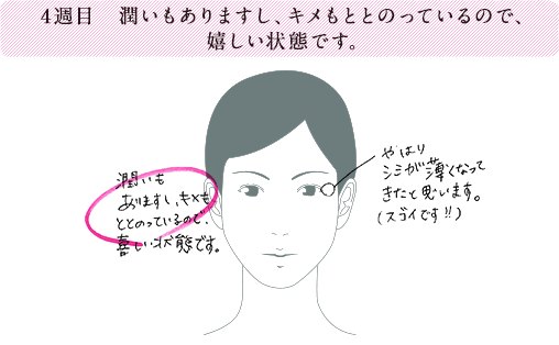 4週目 潤いもありますし、キメもとともっているので、嬉しい状態です。