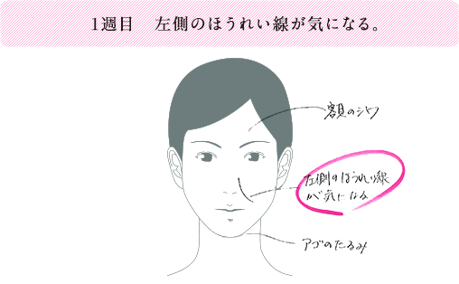 1週目 左側のほうれい線が気になる。