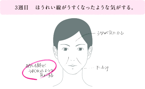 3週目 ほうれい線がうすくなったような気がする。