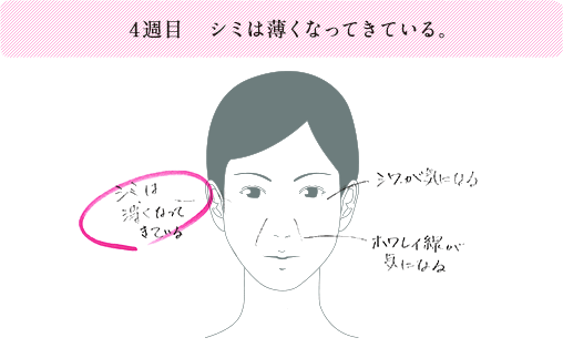 4週目 シミは薄くなってきている。