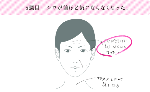5週目 シワが前ほど気にならなくなった。