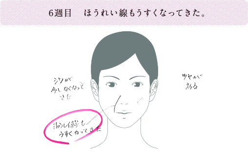 6週目 ほうれい線もうすくなってきた。