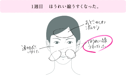 1週目 ほうれい線がうすくなった。