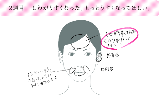 2週目 しわがうすくなった。もっとうすくなってほしい。