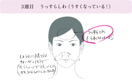 3週目 うっすらしわ（うすくなっている！）