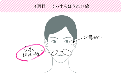 4週目 うっすらほうれい線