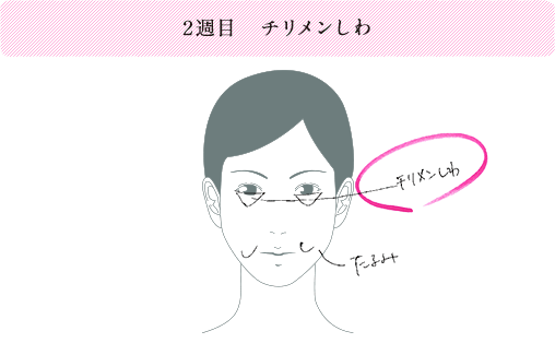 2週目 メリチンしわ。