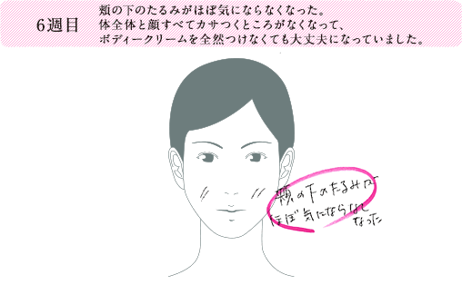 6週目 頬の下のたるみがほぼ気にならなくなった。体全体と顔すべてカサつくところがなくなって、ボディークリームを全然つけなくても大丈夫になっていました。