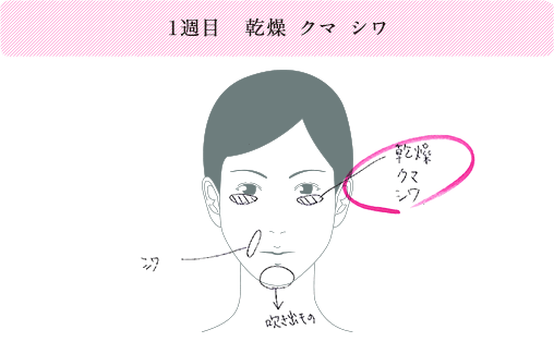 1週目 乾燥　クマ　シワ。