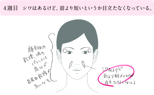 4週目 シワはあるけど、前より短いというか目立たなくなっている。