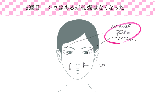 5週目 シワはあるが乾燥はなくなった。