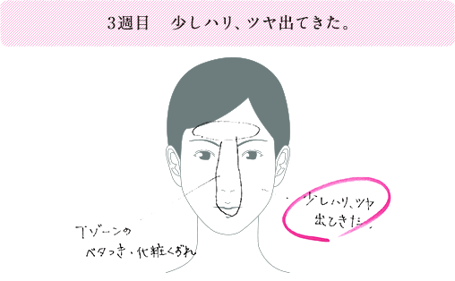 3週目 少しハリ、ツヤが出てきた。